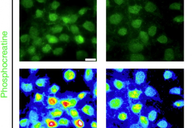 Decreased nuclear phosphocreatine level, a ATP-derived metabolite, in the nucleus of WT and RANBP2-truncated human induced pluripotent cells.