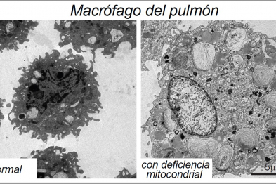  Imagen obtenida por microscopia electrónica de un macrófago pulmonar de un ratón normal (izquierda) y un macrófago con deficiencia en la fosforilación oxidativa mitocondrial (derecha). Las estructuras parecidas a espirales representan acumulaciones de grasa y colesterol.