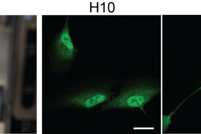 The photograph on the left shows a protein-based biomaterial (orange) suspended between the clamps of a universal traction testing machine, used to characterize mechanical properties (biomaterial and machine designed in-house). The immunofluorescence images show the nuclear and cytoplasmic localization of the protein YAP in human retinal cells and how this distribution is determined by the mechanical properties of the material used as the extracellular matrix.