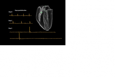 Figura con una secuencia 3D de resonancia magnética nuclear (RMN) cardíaca de un corazón de ratón infectado con el virus de gripe más patogénico y los trazados de ECG mostrando las alteraciones del ritmo cardíaco a distintos días postinfección