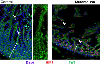 Figure. Heart sections (gestational day 14.5) from a control mouse (left) and a mouse lacking the protein Vhl (right), showing the loss of HIF1 immunofluorescence in the control contrasting with the high levels in the mutant, both in the trabeculae (arrowheads) and compact myocardium (bars). Sustained expression of HIF1 in the mutant results in a marked thinning of the compact myocardium.