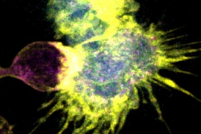 Aurora A y Filamentos de Actina en la Sinapsis Inmunológica de un Linfocito T con una Célula Dendritíca (Fotografía tomada del Microscopio Confocal por Eugenio Bustos-Morán, autor del artículo).