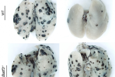 Imagen de pulmones con metástasis en ratones silvestres (WT) y deficientes en células dendríticas DC1 (Batf3-/-) que demuestra que las células dendríticas DC1 son necesarias para la eficiencia de la inmunoterapia del cáncer tras vacunación con antígenos tumorales.