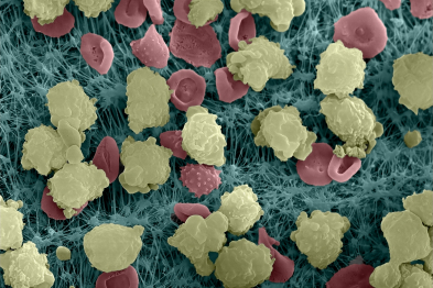 Imagen de microscopía electrónica de neutrófilos (en amarillo), las células objeto del estudio.