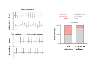 La inhibición de la calpaína reduce las arritmias ventriculares. Registros electrocardiográficos representativos de ratones con la enfermedad, sin tratar o tratados con un inhibidor de la calpaína, tras la administración de adrenalina para desencadenar las arritmias (izquierda). El tratamiento redujo la proporción de animales que desarrollaron taquicardia ventricular sostenida (derecha).