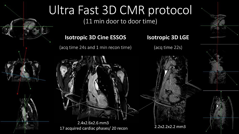 Visualización 3D de los estudios de anatomía, función y caracterización tisular adquiridos con el protocolo utra-rápido.